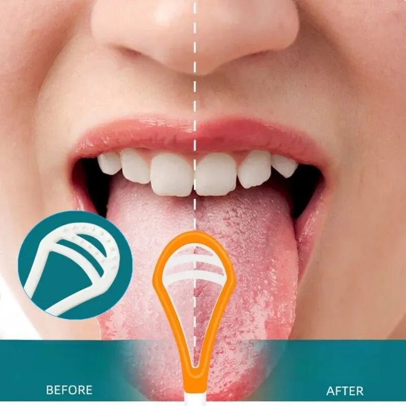 CleanSwipe™ Tongue Scraper – Fresh Breath in Seconds