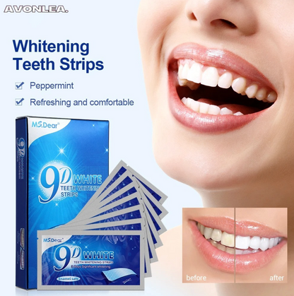 BrightSmile: Teeth Whitening Strips – 7 Pairs (14 Strips)